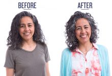 Before and After photo